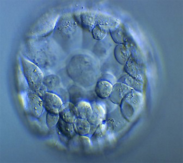 embryon-blastocyte